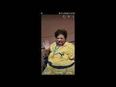 Amputee bbw